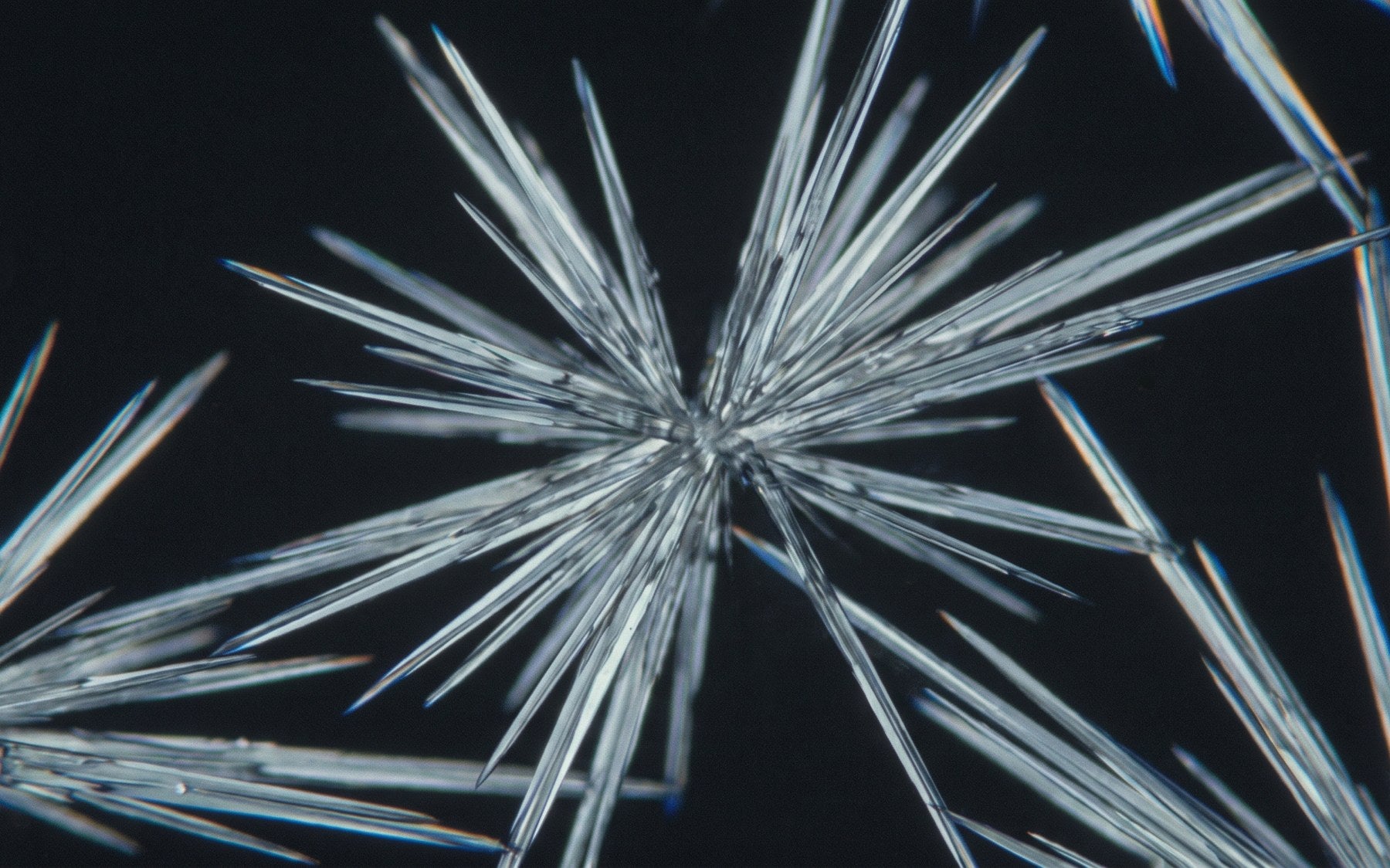 Uric acid crystals under a microscope